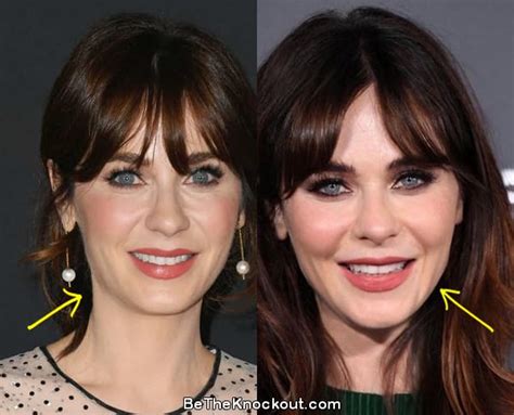 zooey deschanel facelift|Zooey Deschanel’s Bio, Plastic Surgery, Ex